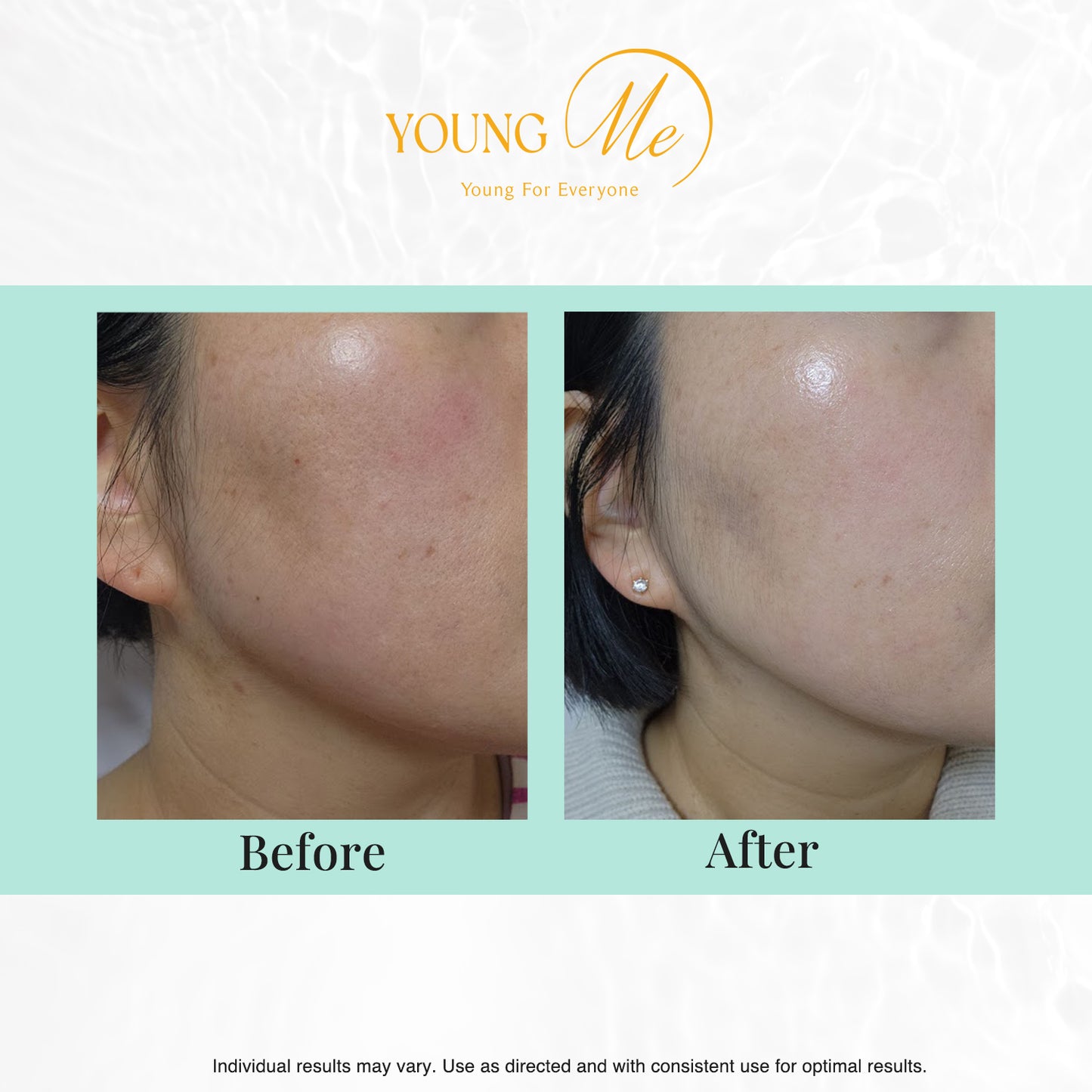 YOUNGME Soothing Glam UVIR Skincare Advanced K-Beauty Sheet Mask - Hydrating, Soothing, and Restoring Hypoallergenic Face Mask for All Skin Types with Aloe Vera and CICA